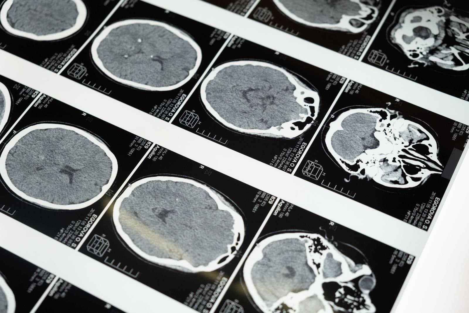 Brain scan imaging used in neuroengineering and brain health research